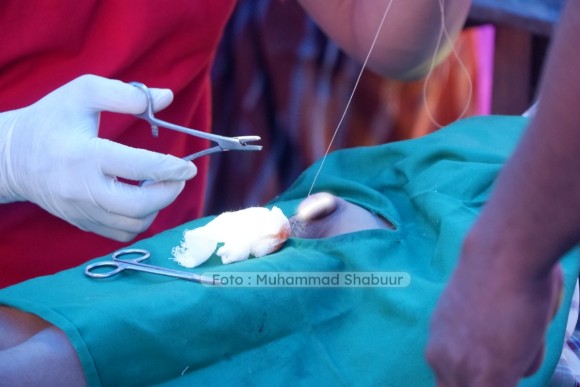 Sunatan Massal LA Center